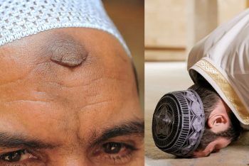 নামাজ পড়তে পড়তে কপালে দাগ ওঠা কি নেককার হওয়ার লক্ষণ?