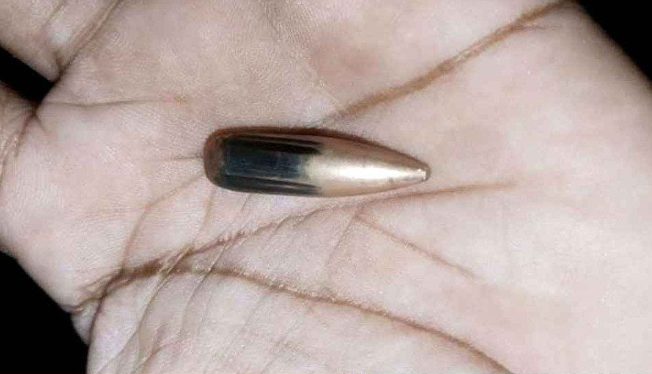 মিয়ানমার থেকে ছোড়া গুলিতে টেকনাফে নারী আহত