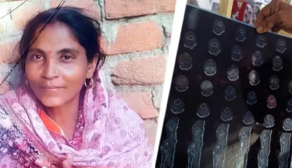 ভারতে পা ভাঙার চিকিৎসা নিতে গিয়ে হলো হাটের অপারেশন; রোগীর মৃত্যু