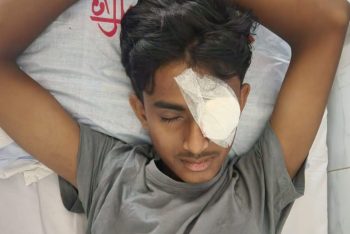 বাম চোখে আর কখনও দৃষ্টিশক্তি ফিরবে না আলিফের