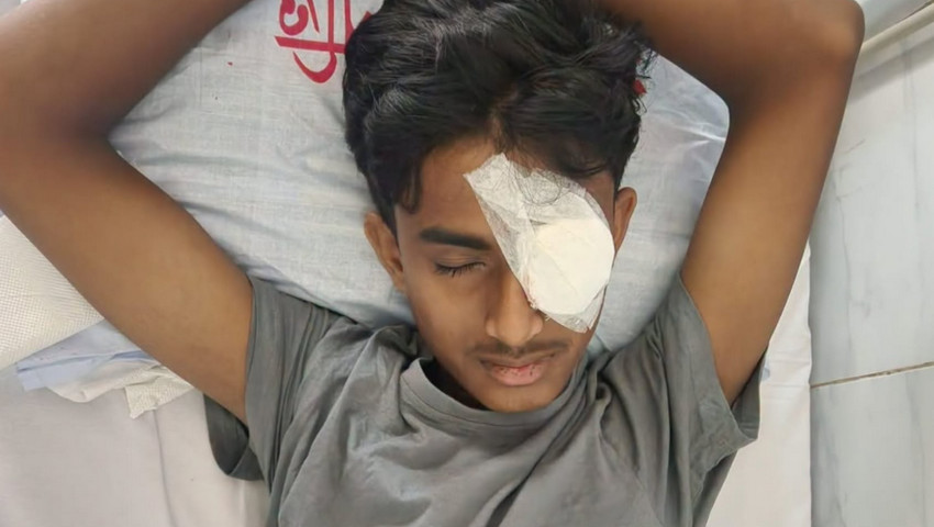 বাম চোখে আর কখনও দৃষ্টিশক্তি ফিরবে না আলিফের